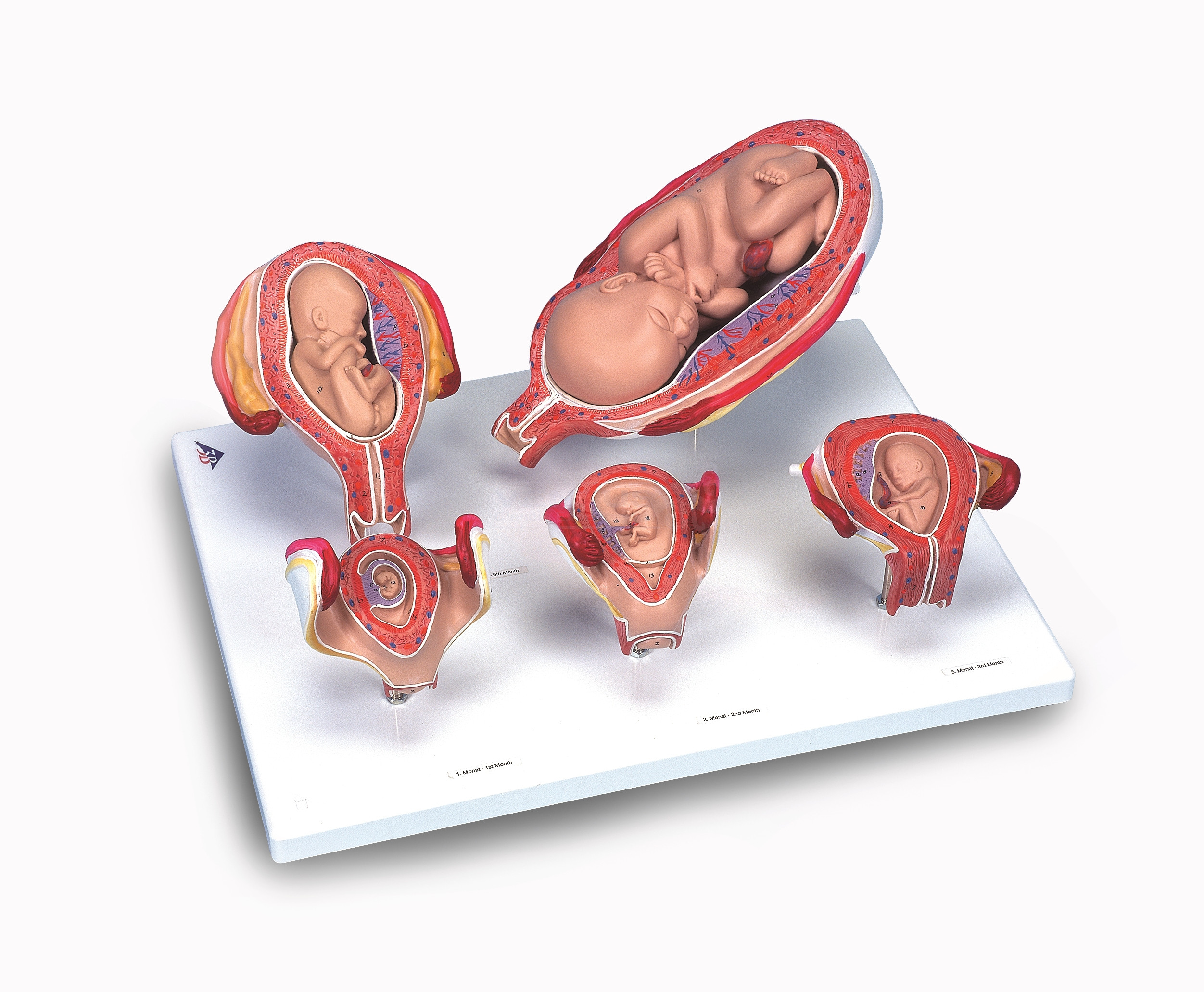 Serie de embarazo, 5 modelos