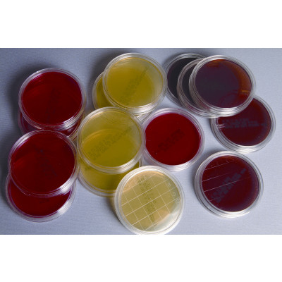 Placas contacto para microorganismos (30x)